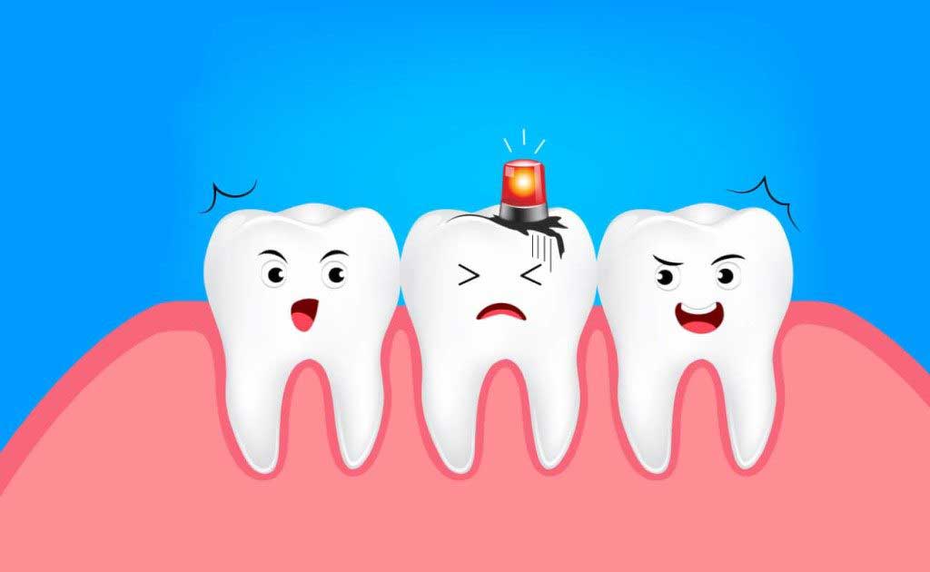 Откуда берется кариес зубов?