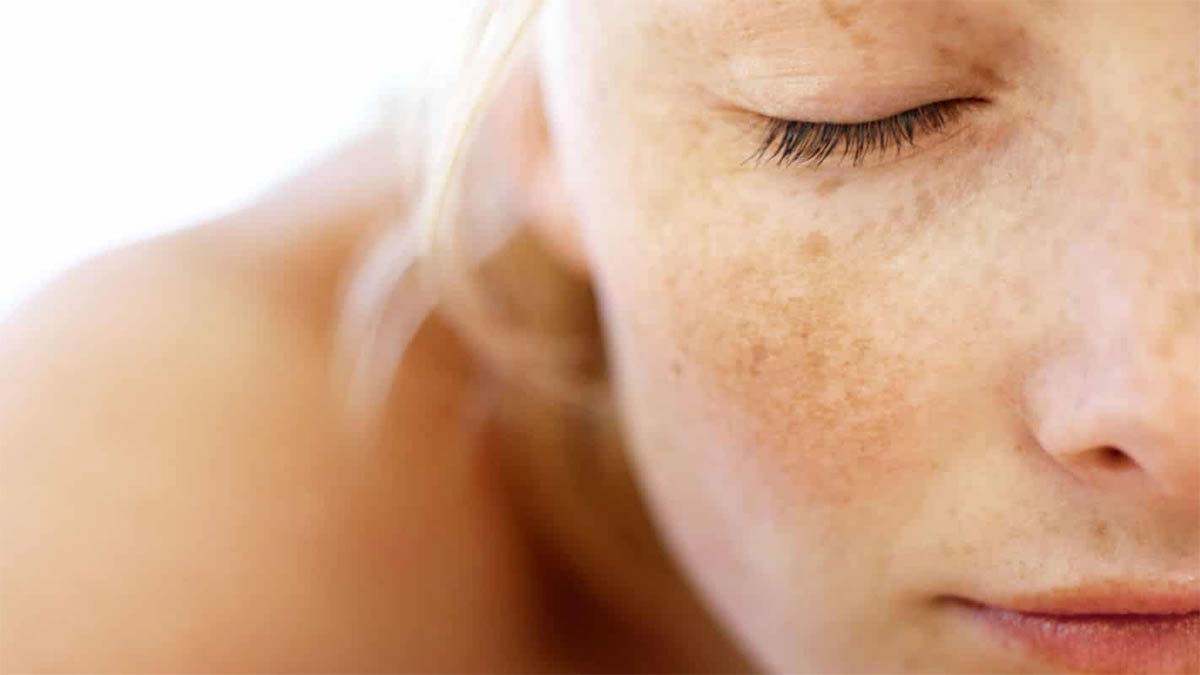 Дисхромия кожи: причины и лечение