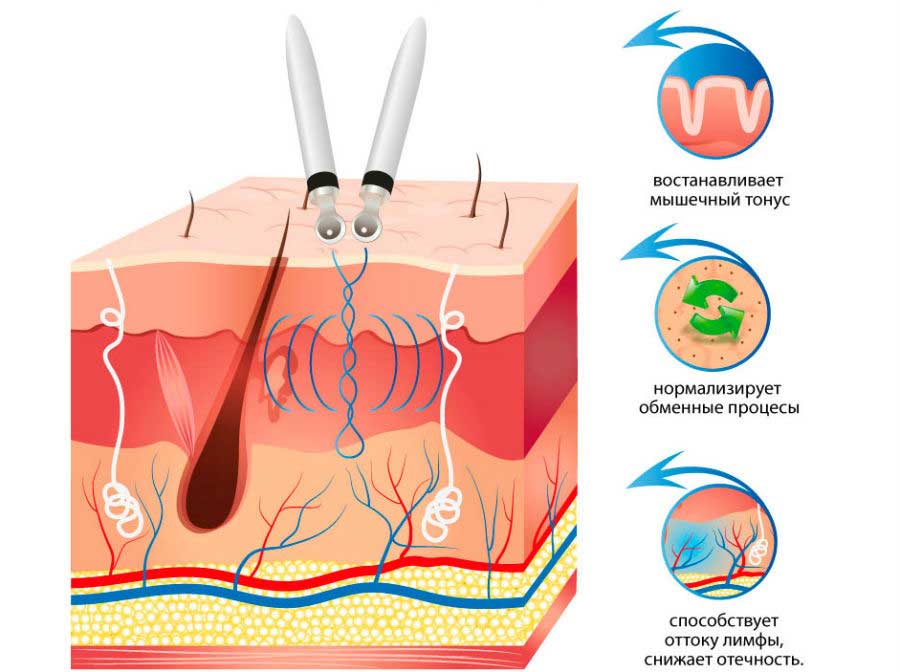Улучшение кожи при помощи микротоковой терапии